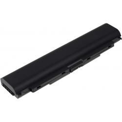 baterie pro Lenovo Typ 45N1160 5200mAh